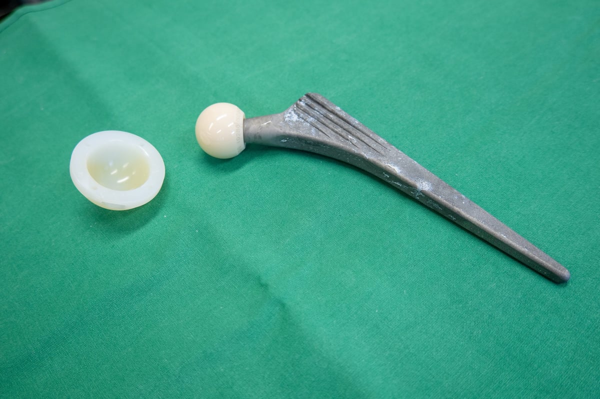 Prótesis de cadera explantada sobre paño quirúrgico, mostrando el componente femoral y acetabular del implante