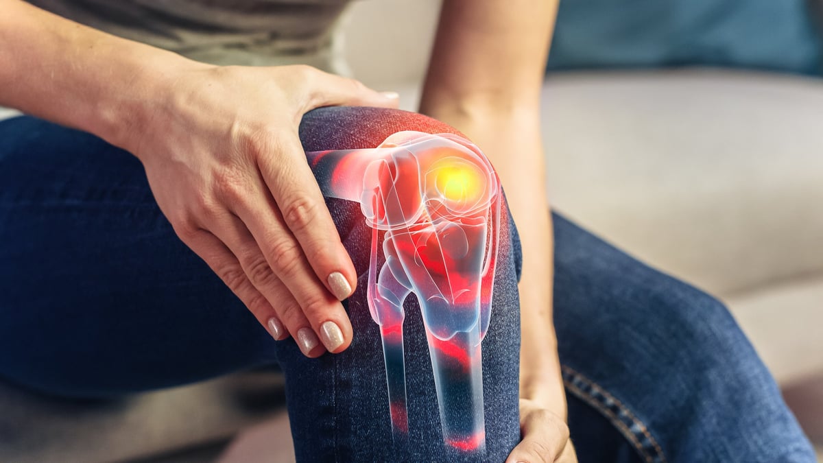 Artrosis de rodilla: ¿qué significa realmente tener desgaste?