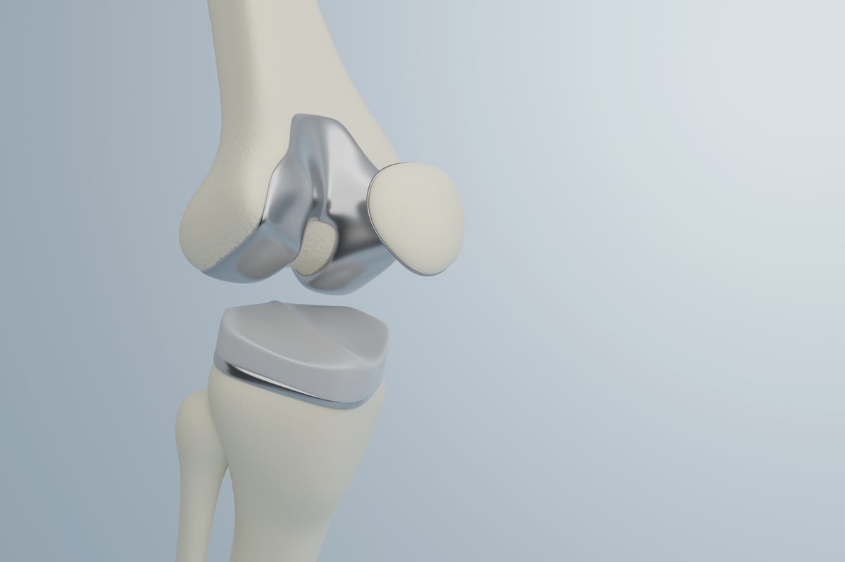 Componente tibial — prótesis de rodilla