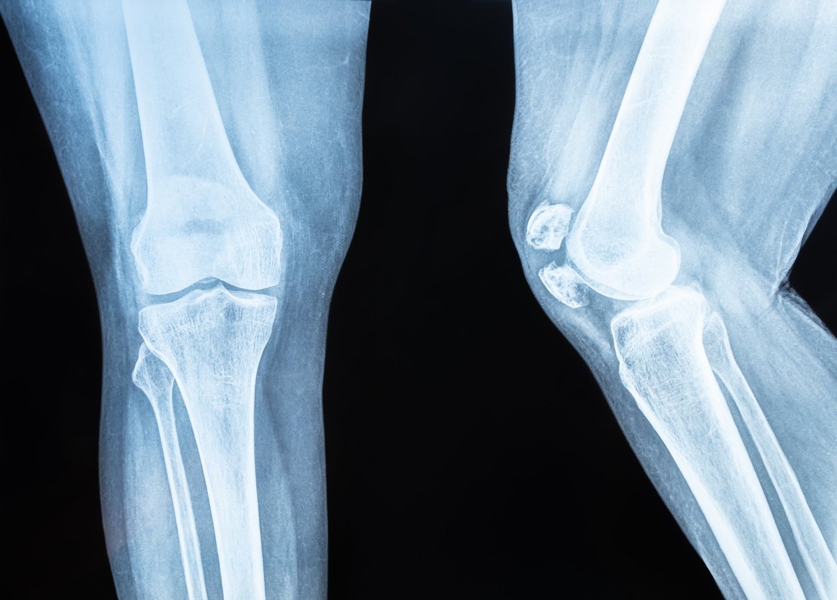Radiografía de rodilla, uno de los estudios que se analizan durante la planificación