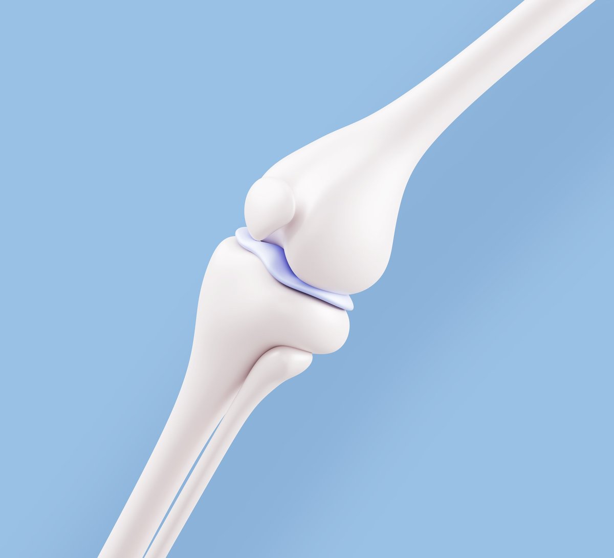 Reconstrucción articular de rodilla — modelo anatómico de precisión