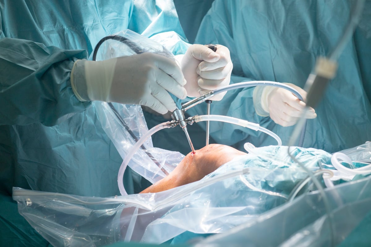 ¿Por qué puede doler la rodilla aunque la radiografía no muestre un desgaste avanzado?