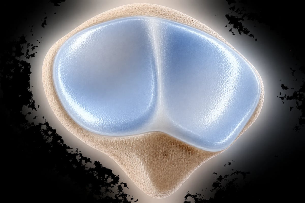 Vista superior de la rótula con su superficie articular cubierta por cartílago